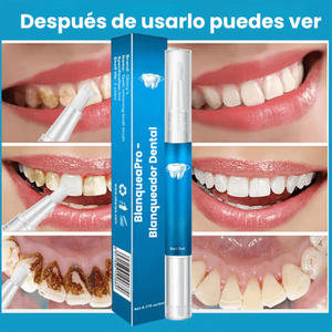 Blanqueador Dental Exprés